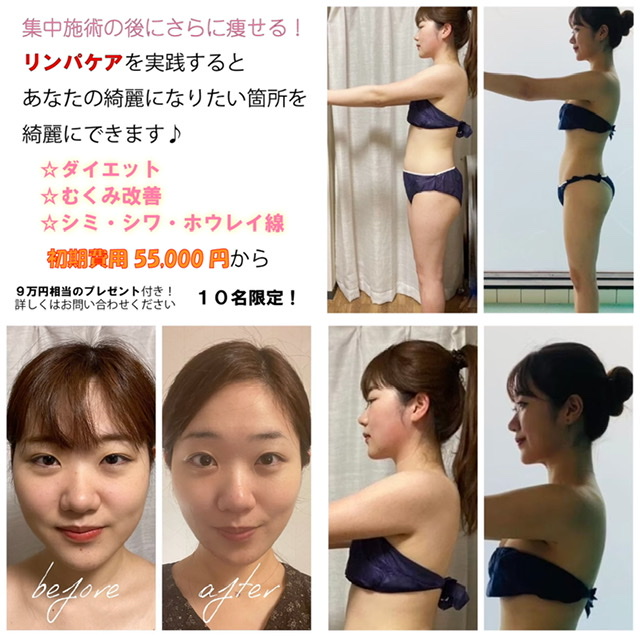 リンパダイエットbefore after