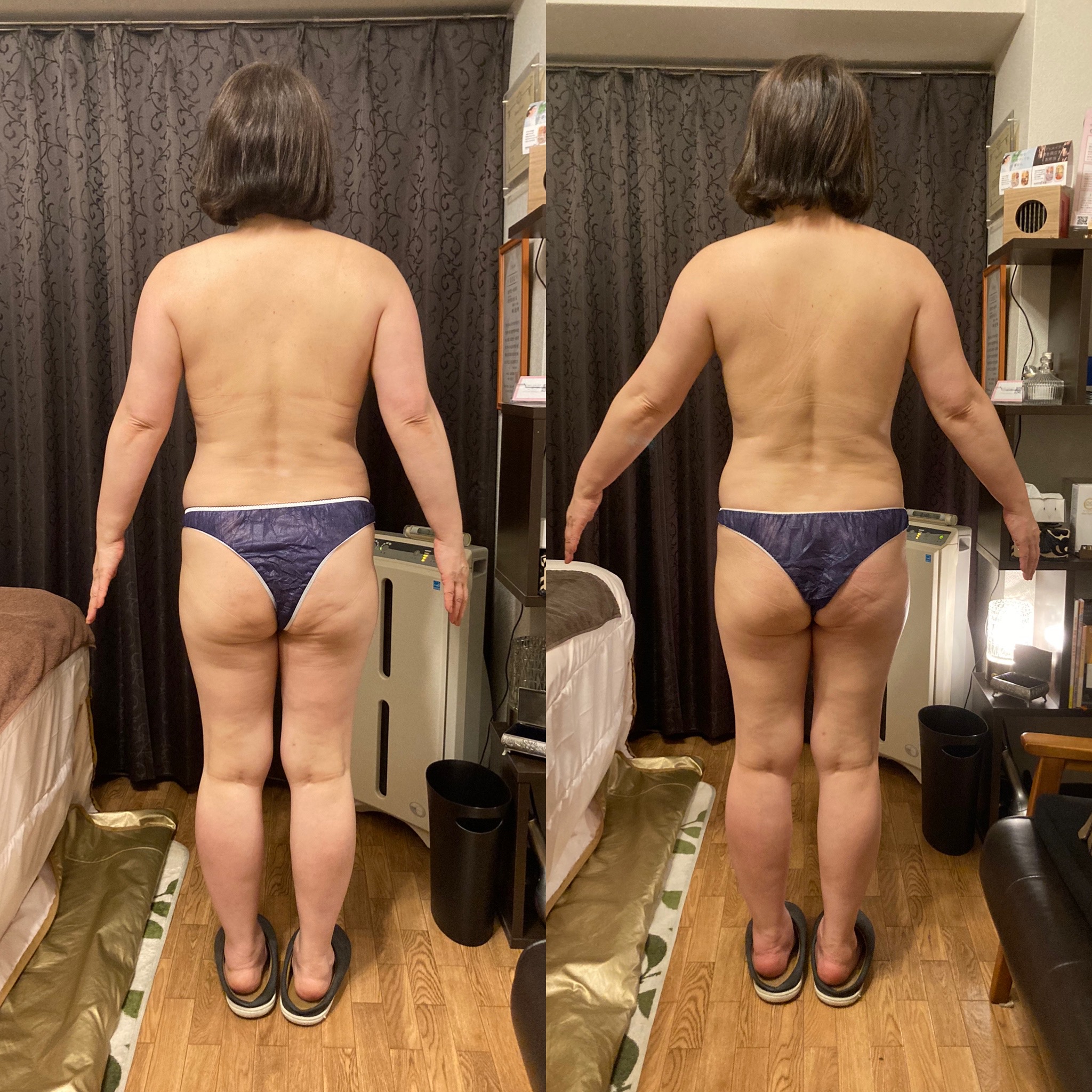 スウェディッシュマッサージ、before/after