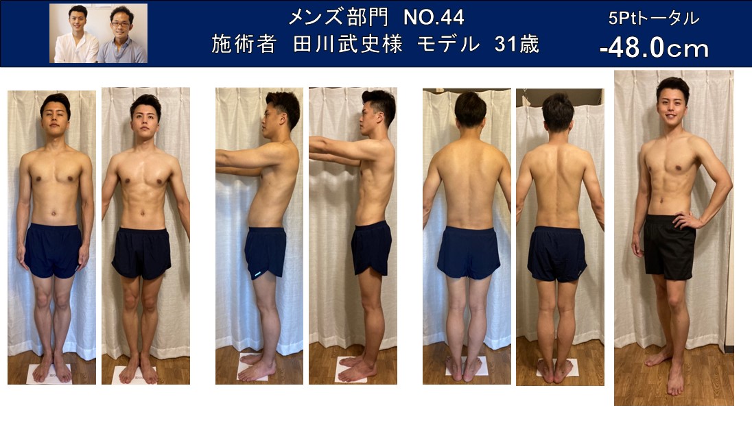 内臓脂肪ダイエット　短期間で驚きの結果 after
