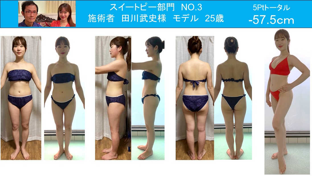 内臓脂肪ダイエット　短期間で驚きの結果 before